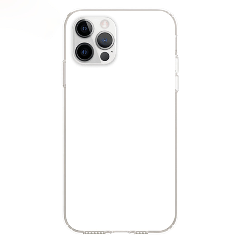 Adorable Peeking Dogs - Customizable Personalized Phone Case for Fashion - Forward Users